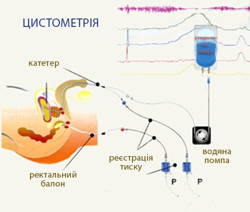 Цистометрія.