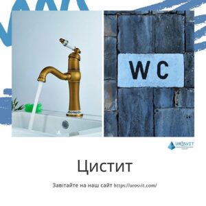 Цистоскопія.