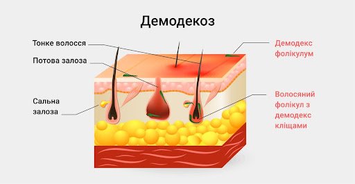 Симптоматика захворювання