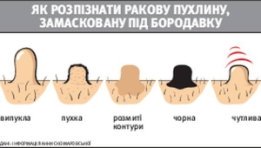 Чим небезпечні бородавки на стопі?