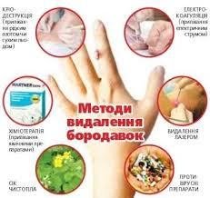 Як позбавитися бородавки на стопі?