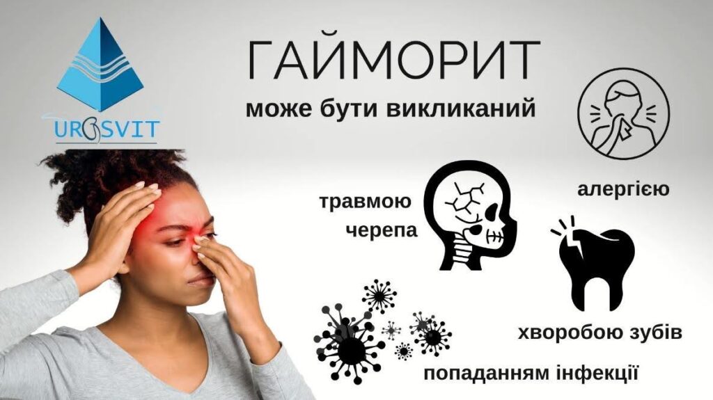 За етіологічними факторами.