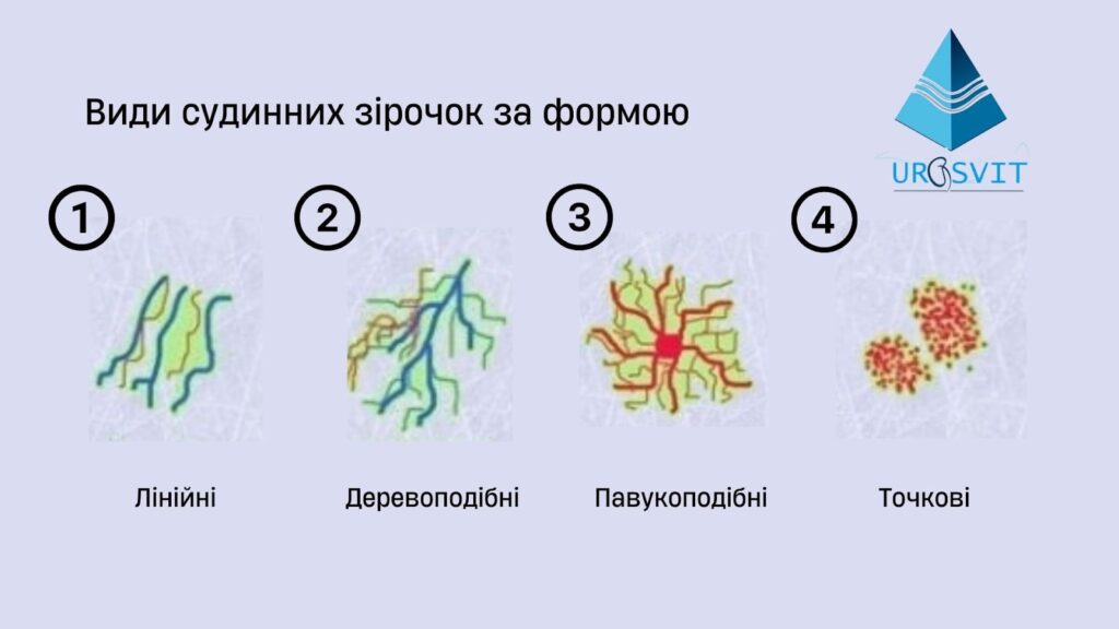 Види судинних зірочок.