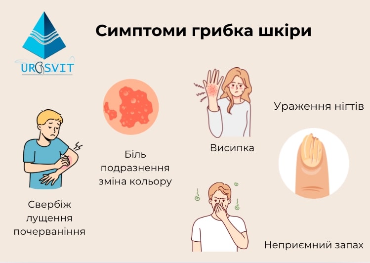 Типи грибкових уражень та симптоми.