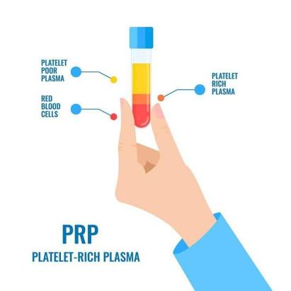 Технологія PRP-терапії для лікування імпотенції.